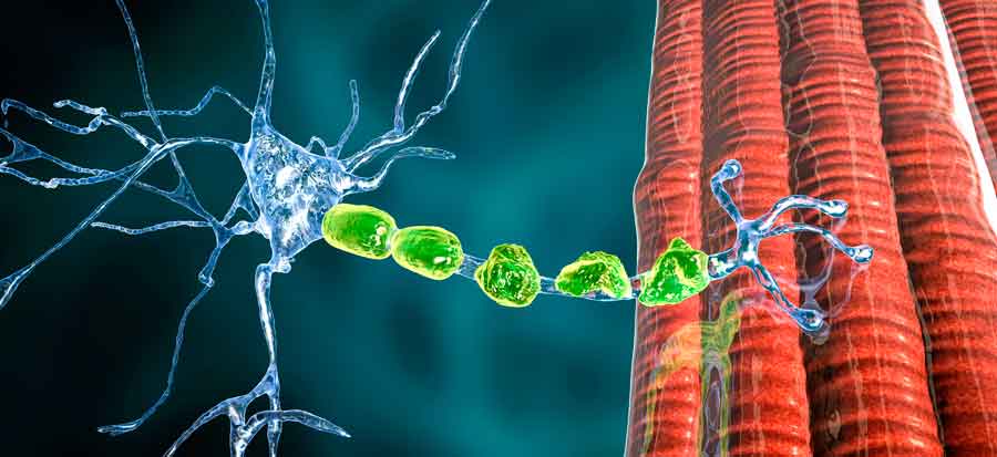 Causas de las neuropatías periféricas del miembro superior mano y muñeca