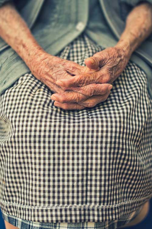 manos con artrosis ancianas, manos-en la 3ª edad. Enfermedades asociadas a la mano degenerativa