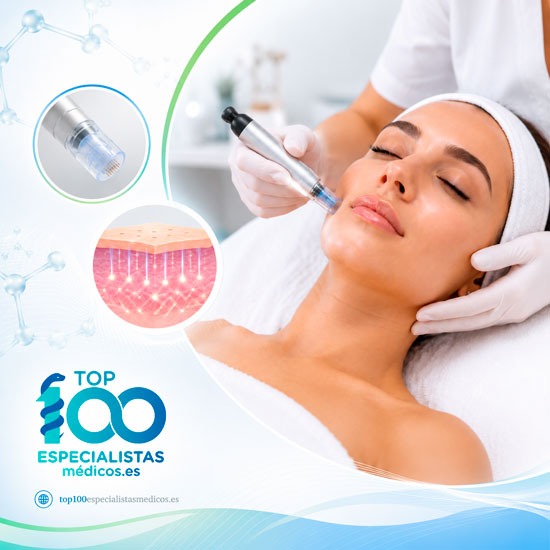 Tratamiento de la piel con Dermapen: beneficios, indicaciones y cuidados