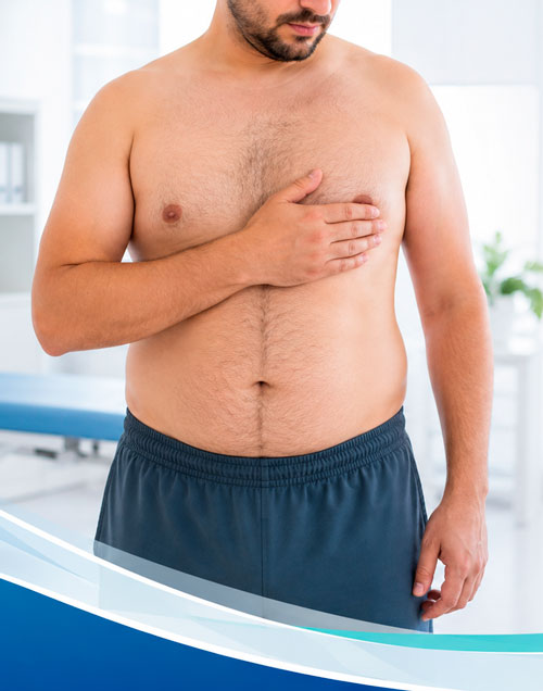 Hombre con ginecomastia sujetando el pecho durante una valoración médica especializada.