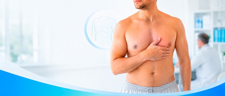 Tratamiento de la ginecomastia masculina